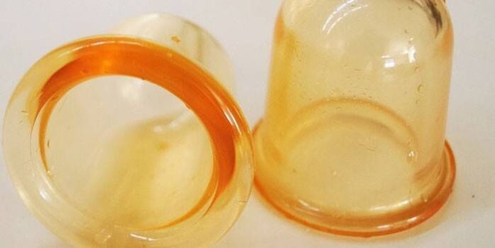 Vasos para o tratamento da prostatite