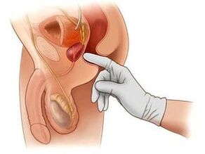 Masaxe prostática para prostatite